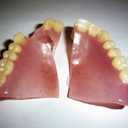 Dentures broken from warping